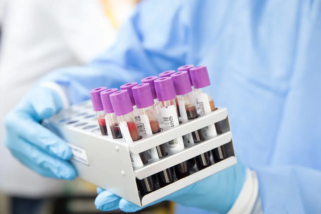 Your Lab Sample — Collected in Minutes, Right Where You Are Life Aid